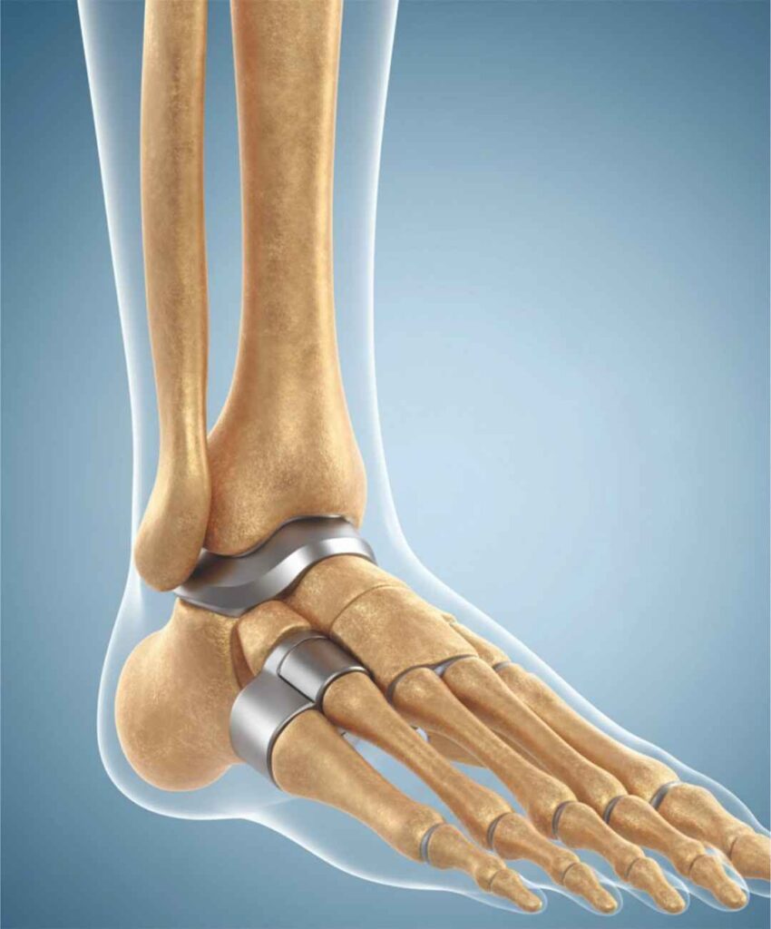 Foot Ankle Surgery ICON