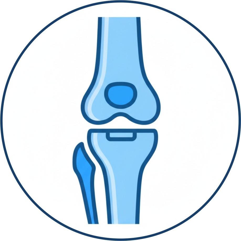 Joint Replacement Arthroplasty icon